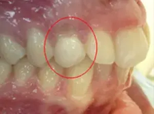 Scopri di più sull'articolo Canino Incluso vestibolare