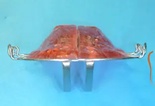 Scopri di più sull'articolo Il saltamorso