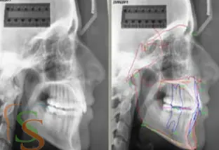 lo studio del caso ortodontico OPT