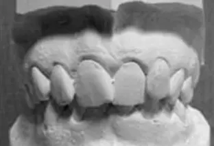 Scopri di più sull'articolo Lo studio del caso ortodontico