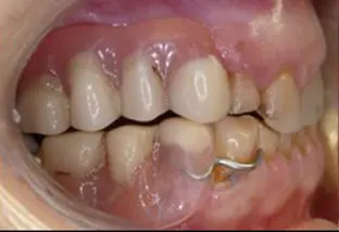 denti vista lato dx